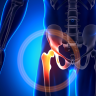 Hip Pain Overview
